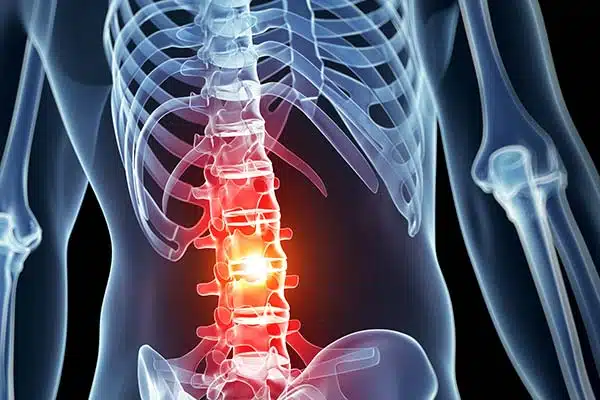 spinal injury attorneys sacramento