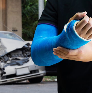What You Should Do After an Auto Collision